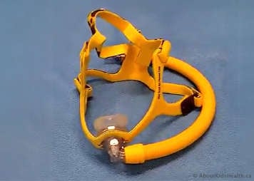 Example of a nasal mask used to BPAP and CPAP therapy