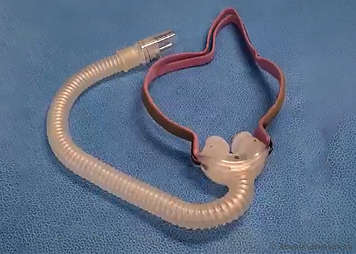 Example of a nasal pillow mask used to BPAP and CPAP therapy
