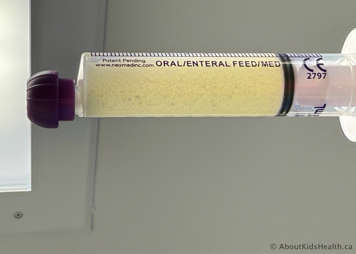 Oral syringe with disintegrated medication so that the liquid inside now looks a little yellow with very small granules