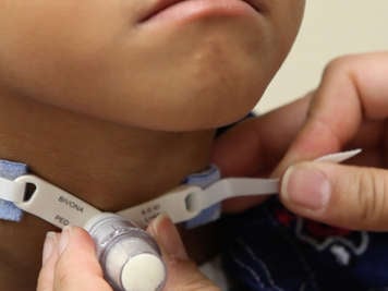 Loosening the ties on one side of a tracheostomy tube.