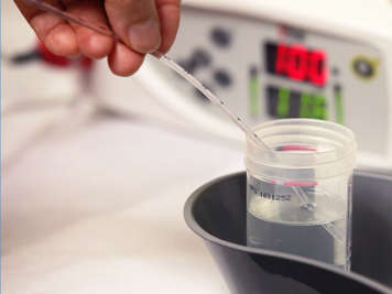 Person dipping the tracheostomy catheter into sterile water before suctioning