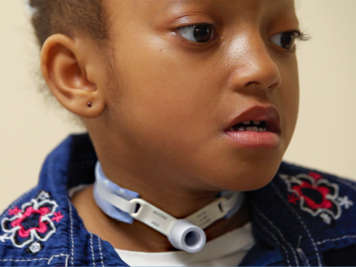 A child with a tracheostomy tube.