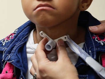 Holding a tracheostomy tube in place