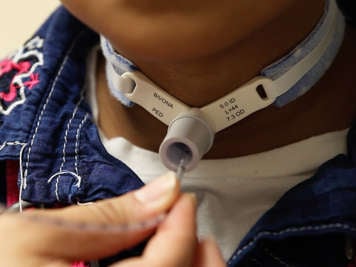 Suctioning a tracheostomy tube