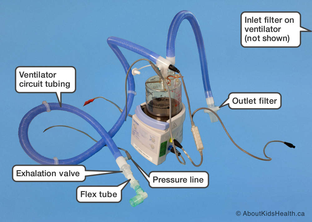 Parts of a wet passive ventilator circuit, as listed above