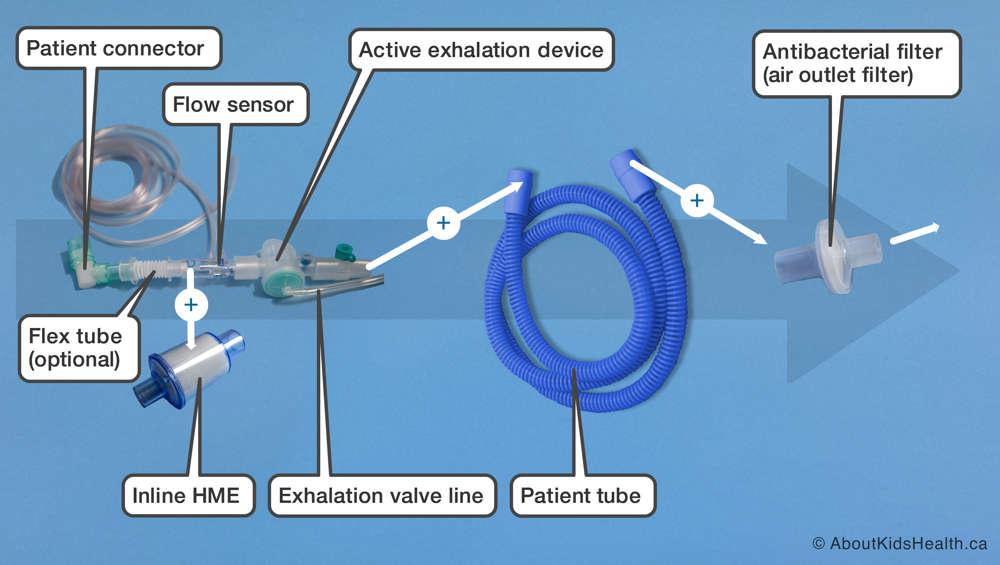 Parts of an active flow pediatric ventilator circuit as listed