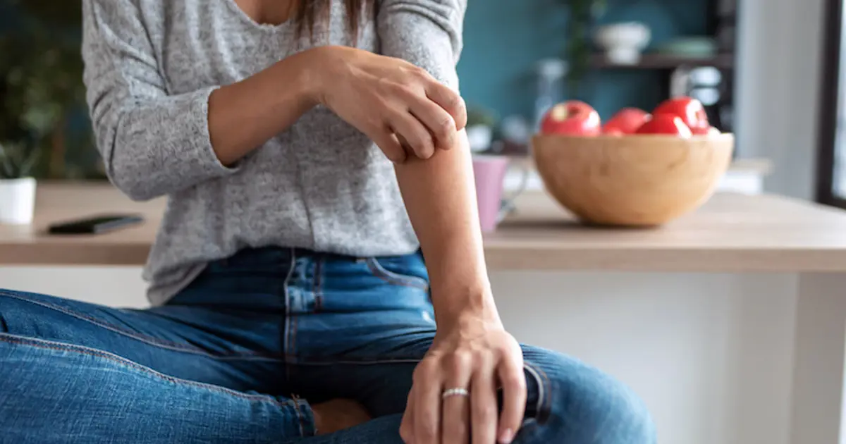 Pityriasis rosé de Gibert