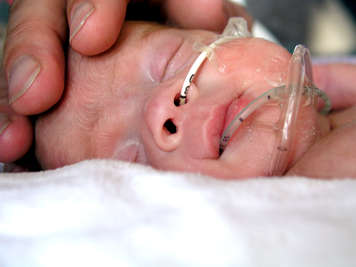 Close-up of sleeping preemie