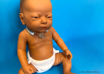 Child sitting comfortably with a tracheostomy tube