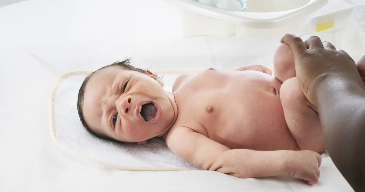 Diaper rash