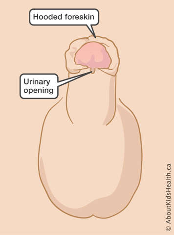 The urinary opening is slightly lower than the head of the penis, and the foreskin is hooded.