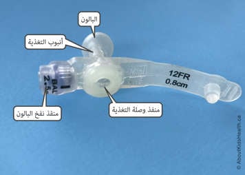 Parts of an AMT MiniONE low-profile G tube