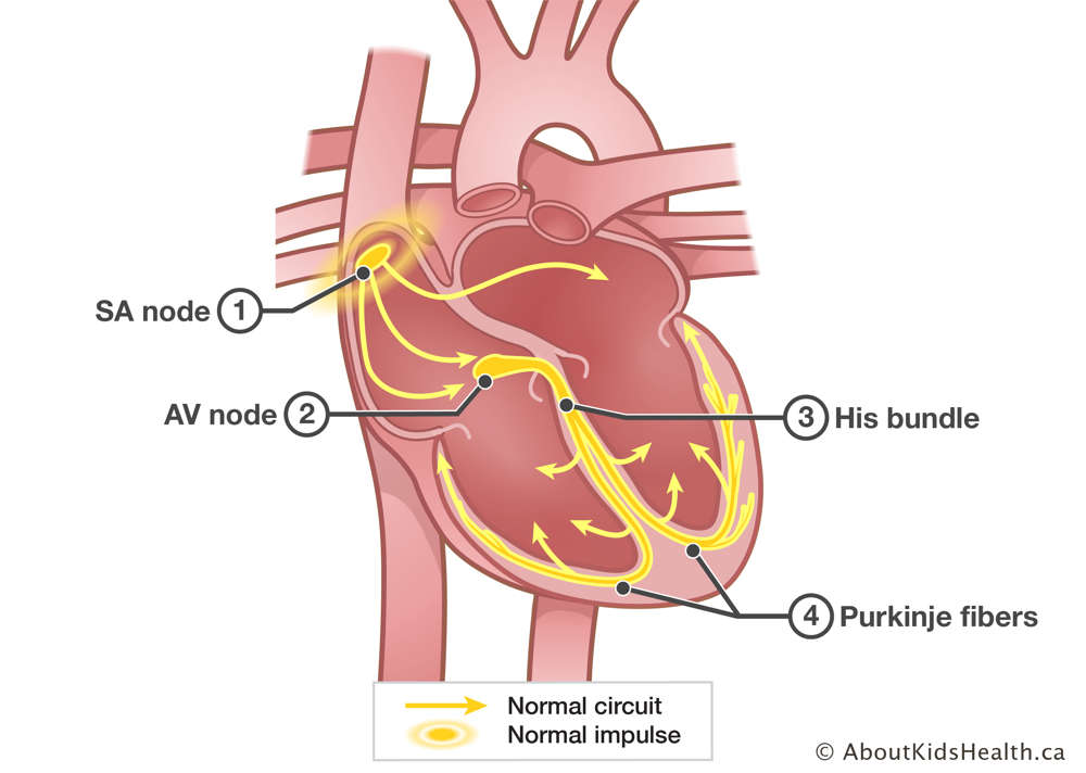 Normal heart showing placement of the SA node, AV node, His bundle and Purkinje fibers