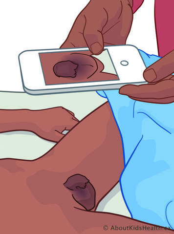 Smartphone with the camera open held above a child's penis in its resting position while the child lies on their back