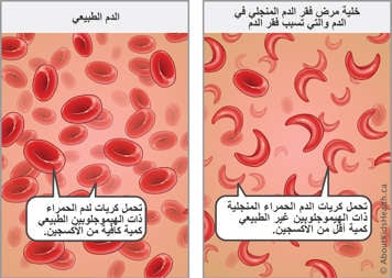 تحمل خلايا الدم الحمراء ذات الهيموجلوبين الطبيعي ما يكفي من الأكسجين، بينما تحمل خلايا الدم الحمراء المنجلية ذات الهيموجلوبين غير الطبيعي كمية أقل من الأكسجين.