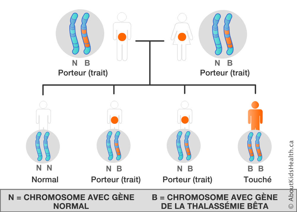 La distribution des chromosomes d’un homme et d’une femme, chacun avec un chromosome avec un gène de bêta-thalassémie