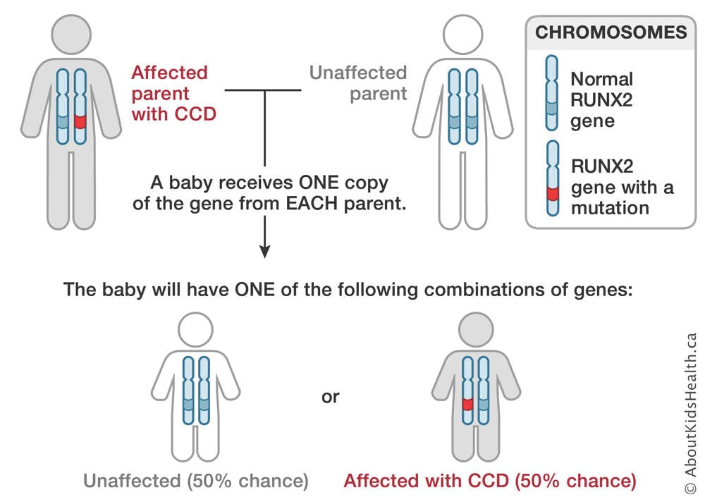 Chromosome distribution from an affected parent with CCD and an unaffected parent