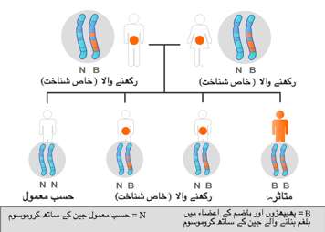 والدین کی طرف سےکروموسوم کی ڈسٹری بیوشن جن میں موروثی مرض ہوتا ہے
