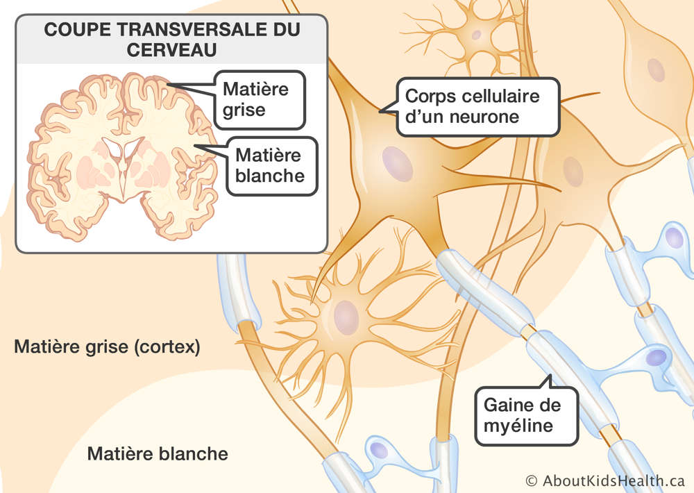 Coupe transversale du cerveau avec matières grise et blanche, corps cellulaire d’un neurone et gaine de myéline identifiés
