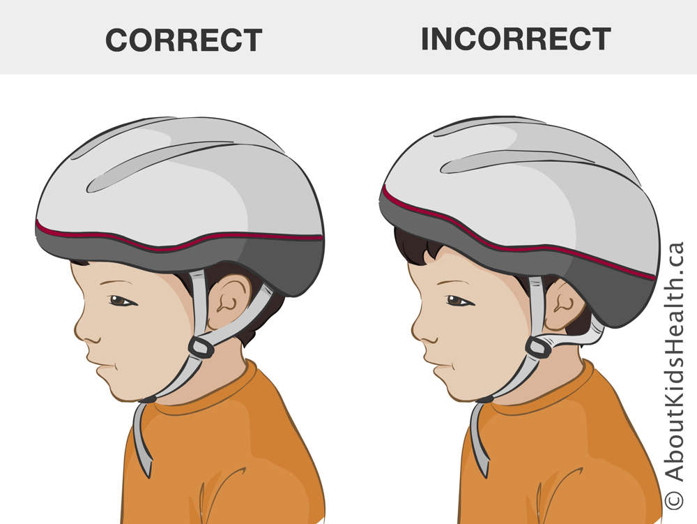 Correct helmet position and incorrect helmet position