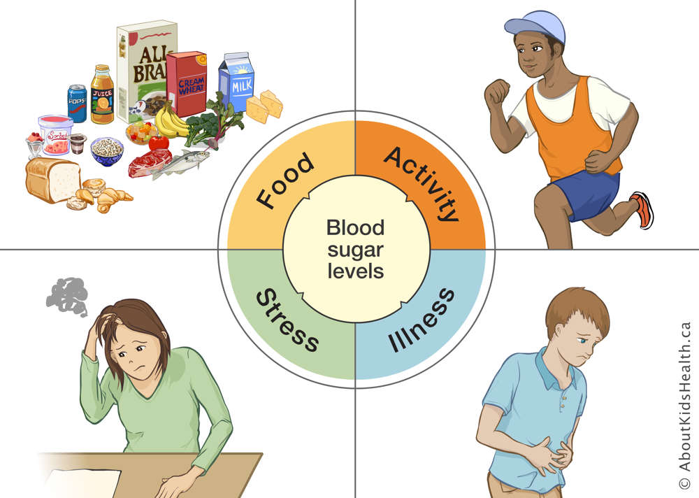 Illustration of factors affecting blood sugar levels