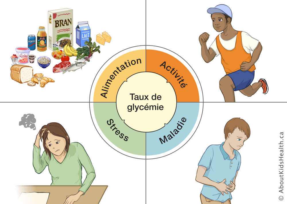 Une illustration des facteurs qui peuvent affecter le taux de glyc&eacute;mie