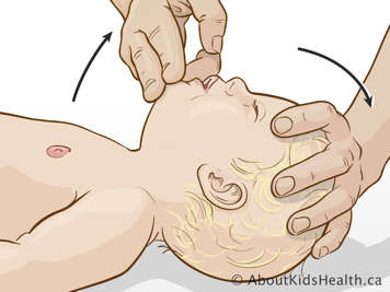 Ouvrant les voies respiratoires pour donner les respirations de sauvetage
