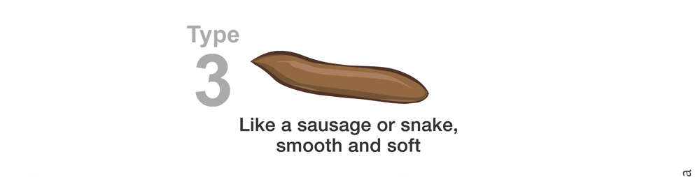 illustration showing different consistencies of poo