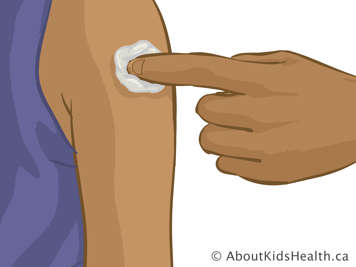 Holding cotton ball to upper arm