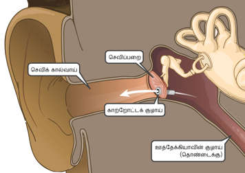 ஊத்தேக்கியாவின் குழாயிலிருந்து காதுக் கால்வாய்க்குள் வளியை அனுமதிக்கும் காற்றோட்டக்குழாய்