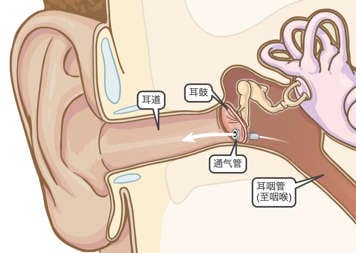 耳内的通气管结构,保证了从耳咽管至耳道的空气畅通