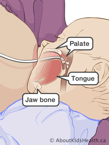 Correct position of lactation aid tube in baby&rsquo;s mouth