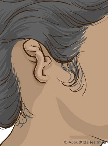 Ear that is small and scrunched