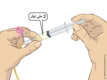 Two millilitres of liquid in a syringe attached to an NG tube