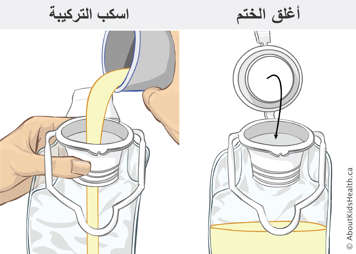 Pouring formula into feeding bag and closing the seal on the feeding bag