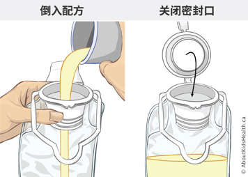 Pouring formula into feeding bag and closing the seal on the feeding bag
