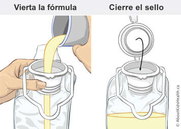 Pouring formula into feeding bag and closing the seal on the feeding bag