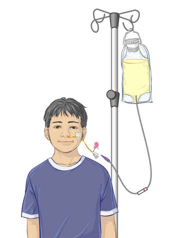 Connect tubes and roller clamp on infusion tubing for attaching a feeding bag to a child&rsquo;s NG tube
