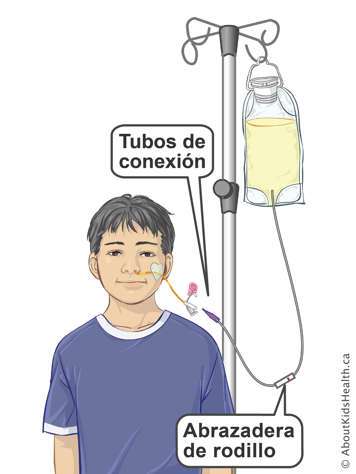 Connect tubes and roller clamp on infusion tubing for attaching a feeding bag to a child&rsquo;s NG tube