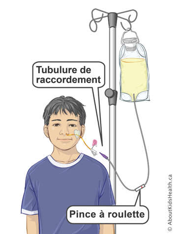Adaptateur et pince &agrave; roulette sur une tubulure de perfusion pour relier le sac d&rsquo;alimentation &agrave; la sonde NG