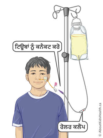 ਬੱਚੇ ਦੀ ਐਨਜੀ ਟਿਊਬ ਨਾਲ ਫੀਡਿੰਗ ਬੈਗ ਜੋੜਨ ਲਈ ਇਨਫਿਊਜ਼ਨ ਟਿਊਬਿੰਗ 'ਤੇ ਟਿਊਬਾਂ ਅਤੇ ਰੋਲਰ ਕਲੈਂਪ ਨੂੰ ਜੋੜੋ।