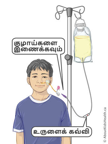 Connect tubes and roller clamp on infusion tubing for attaching a feeding bag to a child&rsquo;s NG tube