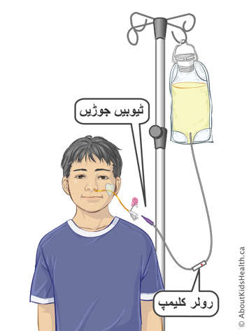 Connect tubes and roller clamp on infusion tubing for attaching a feeding bag to a child&rsquo;s NG tube