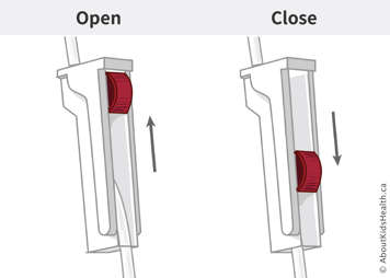 An open clamp and a closed clamp on infusion tubing