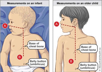 Measurements on an infant and on an older child and location of base of chest bone and belly button on both