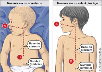 Mesures sur un bébé et sur un enfant plus âgé, avec un doigt sur le bébé et deux doigt sur l’enfant en-dessous du sternum