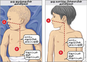ஒரு சிசு மற்றும் ஒரு வளர்ந்த பிள்ளையின் நெஞ்சு எலும்பின் அடி மற்றும் தொப்புள் வரையான அளவீடுகள் மற்றும் அமைவிடம்
