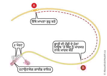 ਛਾਤੀ ਦੀ ਹੱਡੀ ਦੇ ਹੇਠਾਂ ਟਿਊਬ 'ਤੇ ਸ਼ੁਰੂਆਤੀ ਬਿੰਦੂ ਅਤੇ ਬਿੰਦੂ 'ਤੇ ਦੋ ਪੋਰਟਾਂ ਅਤੇ ਹਟਾਉਣਯੋਗ ਗਾਰਡਡ ਤਾਰ ਵਾਲੀ NG ਟਿਊਬ 'ਤੇ ਨਿਸ਼ਾਨ।