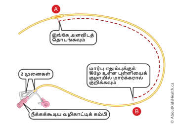 இரு முனைகள் மற்றும் அகற்றக்கூடிய காப்பிடப்பட்ட வயர் கொண்ட NG குழாயில் அடையாளங்கள்