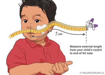 Showing how to measure the length of an NJ tube